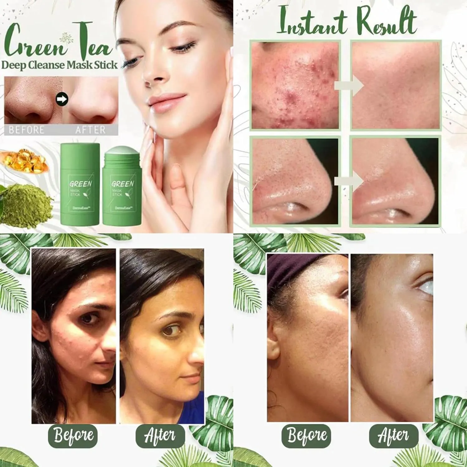 Lukcr Green Tea Mask, Dermaease Deep Cleanse Mask Stick, Green Teas Deep Cleanse Mask, Mask Stick for Pore Cleansing(Green tea   Green tea)